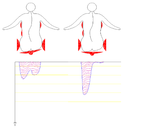 Zásady správnej stabilizácie pacientov s posturálnym deficitom v sedacej polohe